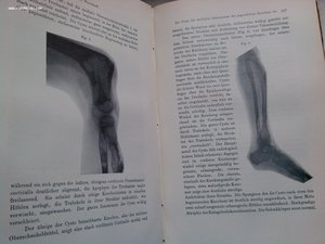 Ортопедическая хирургия 1908 год изд. много иллюстраций !!!