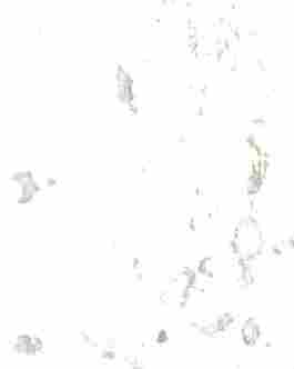 -------