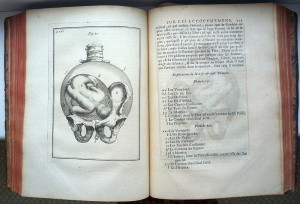 1734 г. Важнейшие наблюдения в акушерстве с гравюрами, Париж