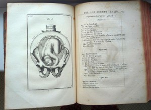 1734 г. Важнейшие наблюдения в акушерстве с гравюрами, Париж