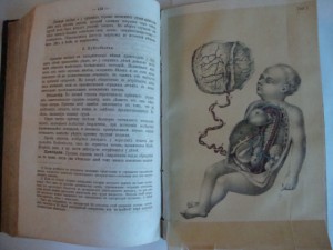 Руководство к изучению детских болезней. 1864г. Фогель.