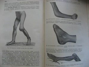 Учебник хирургии 1911г.  177 рисунка.