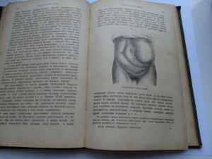 Диагностика хирургических болезней