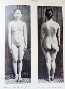 Д-р Штрац "Расовая женскаяч красота" 1904г