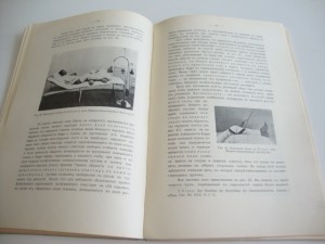 1914г. К.Ф.Вегнер. Закрытые переломы. Харьков