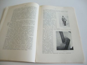 1914г. К.Ф.Вегнер. Закрытые переломы. Харьков