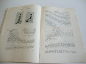1914г. К.Ф.Вегнер. Закрытые переломы. Харьков