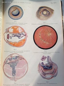 Руководство по глазным болезням 1913 год изд.