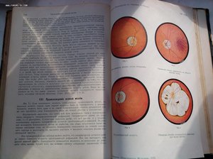 Руководство по глазным болезням 1913 год изд.