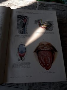 1927г.Хирургия на немецком.1036 страниц.