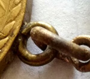 ММ 2 степени ( 1-го типа )