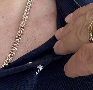 Цепь Бисмарк